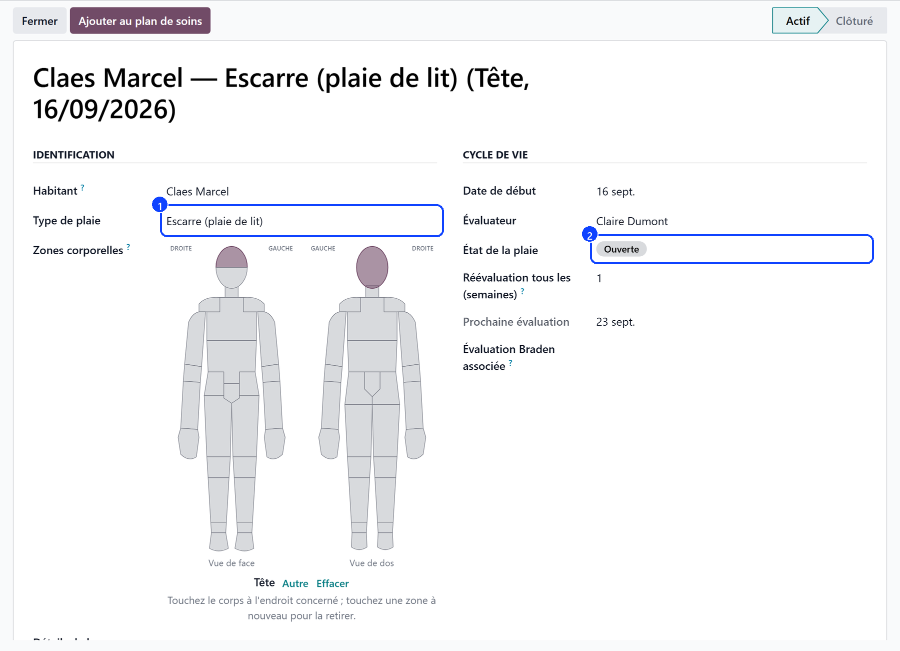 A wound in the register: the type, the body map, the state of the wound and the next review